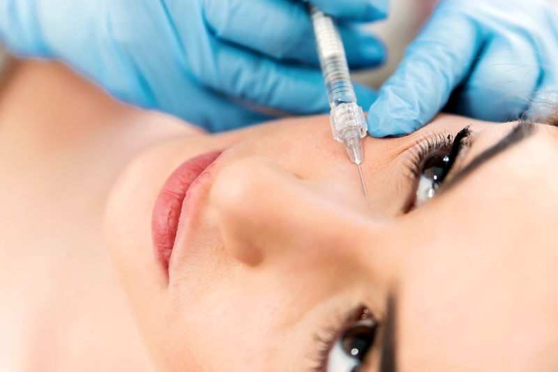 Treatment of dark eye circles with hyaluronic acid
