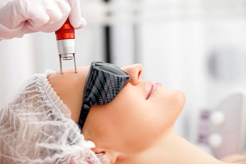 Facial rejuvenation, wrinkle removal with fractional carbon dioxide laser treatment